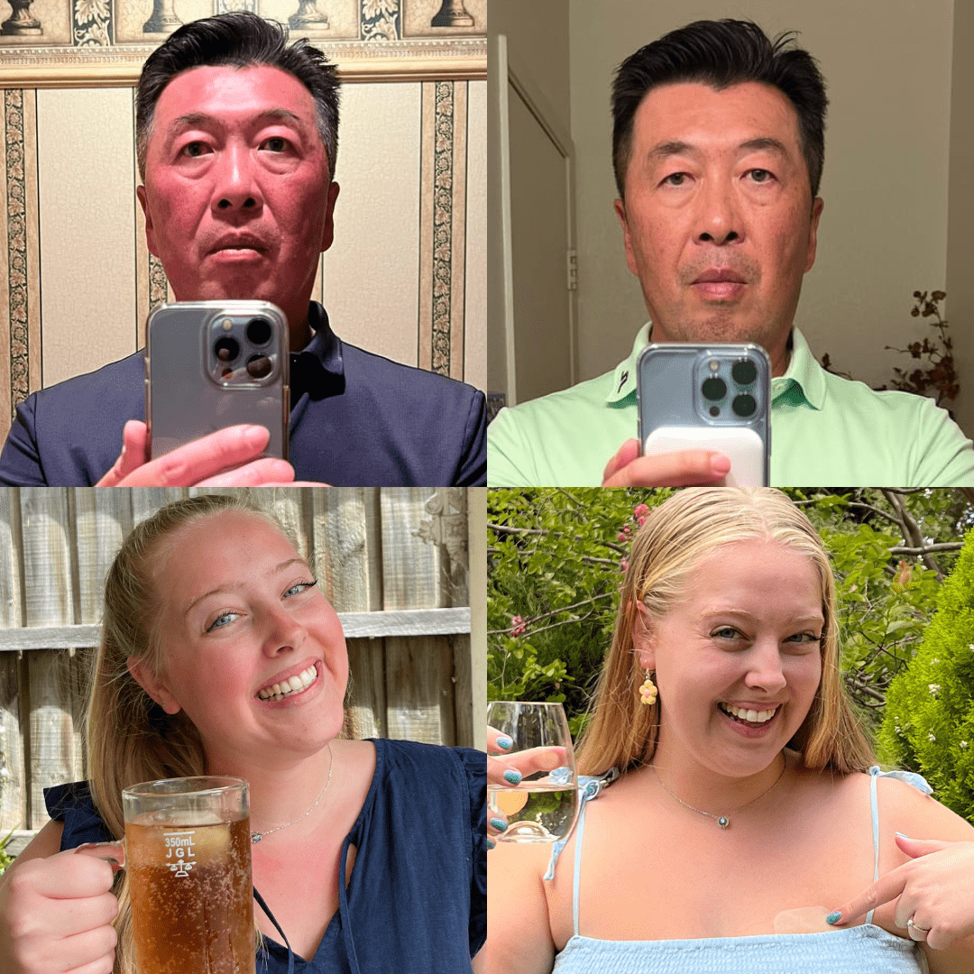 Alcohol Flush Pills before and after results
